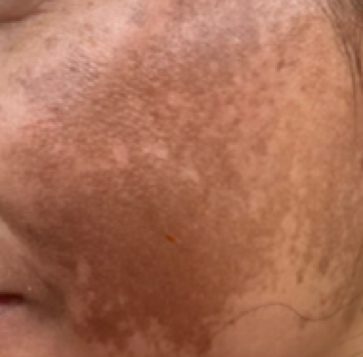 Before/After Image